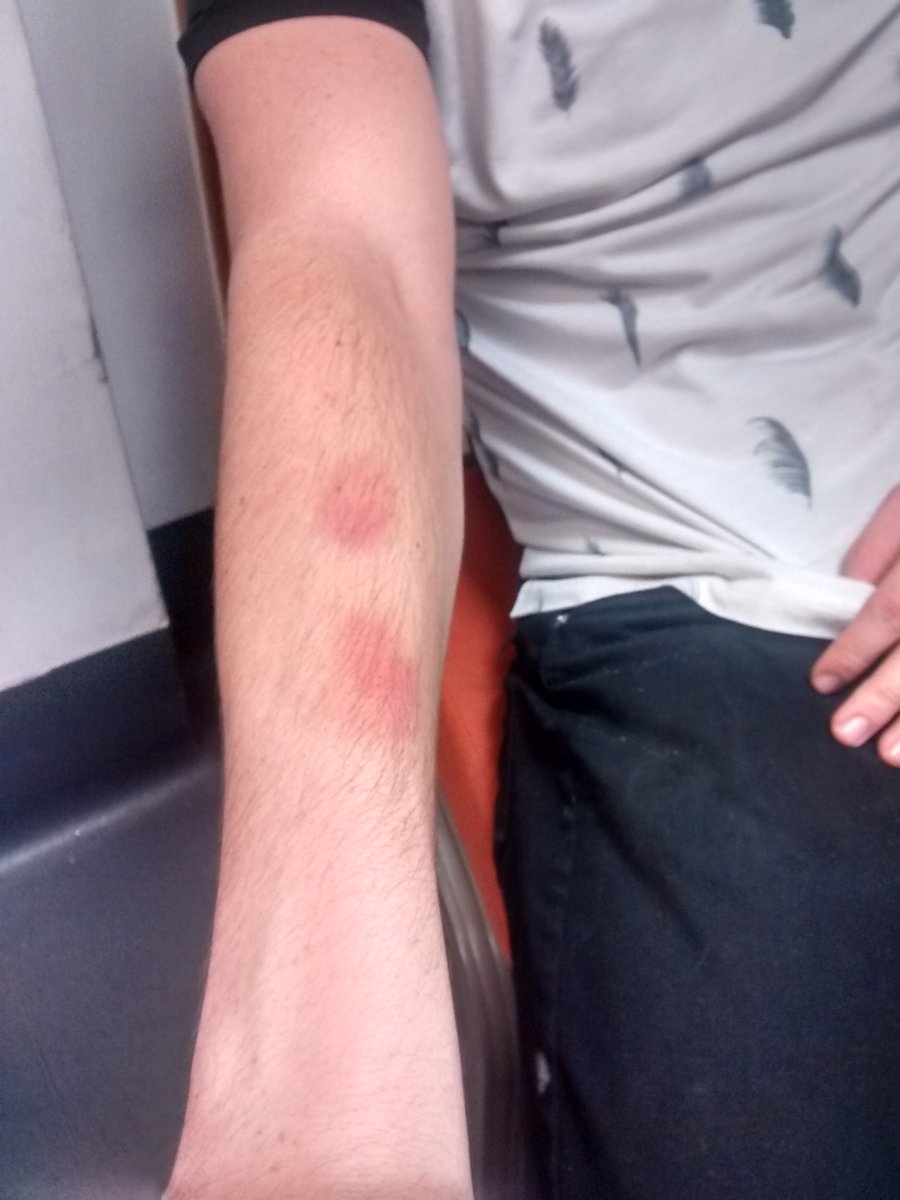 Photo: Picketer assaulted yesterday by SOAS student / Iraq War veteran trying 2 destroy picket line @ValerieAmos 1/2