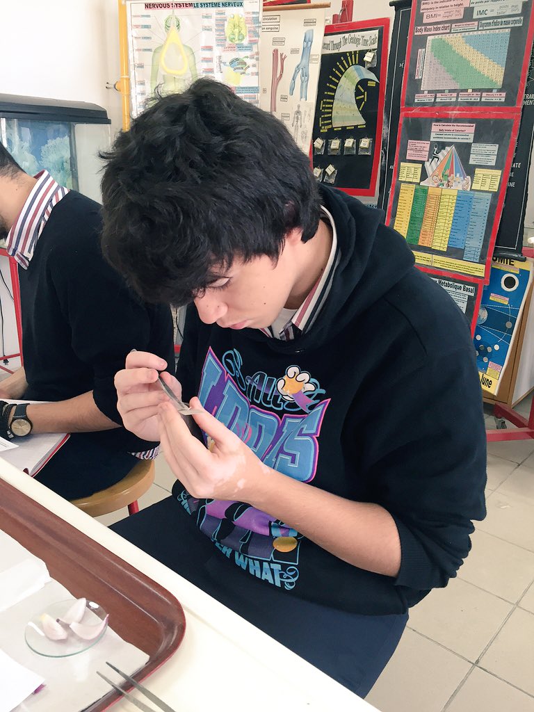 RoweidaB's tweet image. Tracking Plasmolysis in plant cells #CellModel @Hhhsinfo