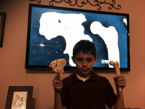CharlesHeim's tweet photo. Happy #fossilfriday #Australopithecine #pelvis and #femur displayed by juvenile #Homosapien sapien https://t.co/KGbYW2ugrA
