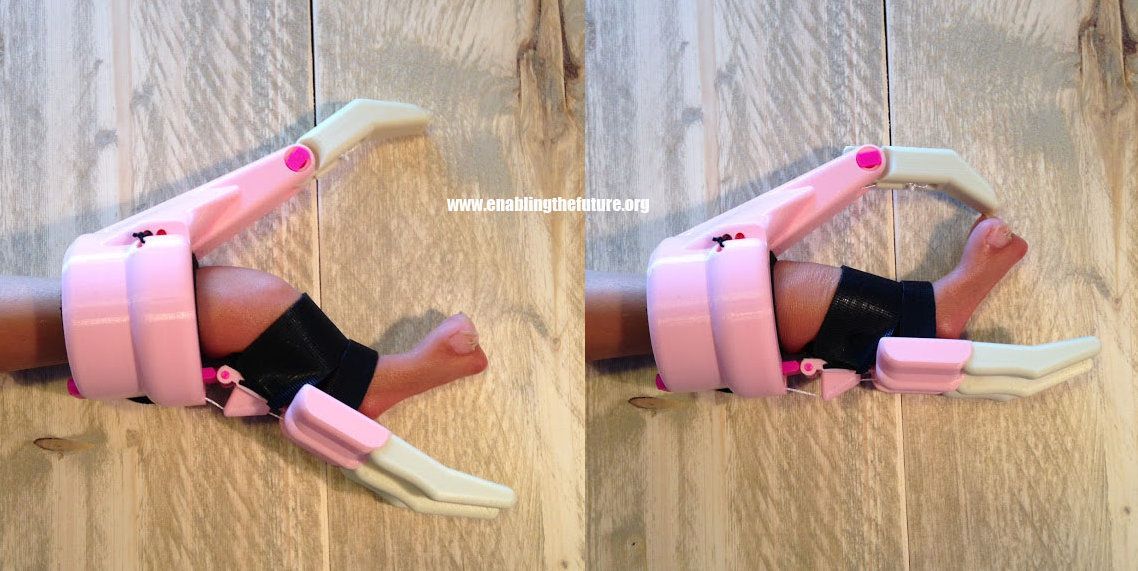 3DPrint_com's tweet photo. e-NABLE Volunteer Successfully Designs Custom #3DPrinted Pinching Hand for Yu-Lia
https://t.co/DzHm3CKfU8 https://t.co/8t3g3uMXui