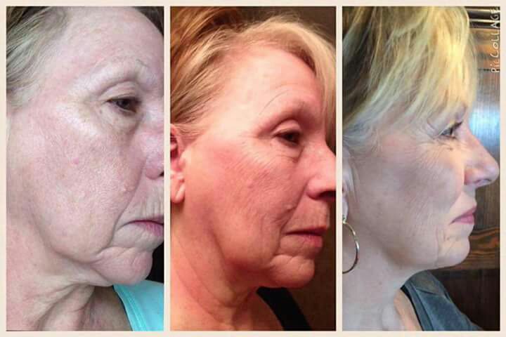 champ_7784's tweet photo. This night cream REALLY works! #Nerium #nightcream #greatskin #realsciencerealresults https://t.co/w32o34NsW9
