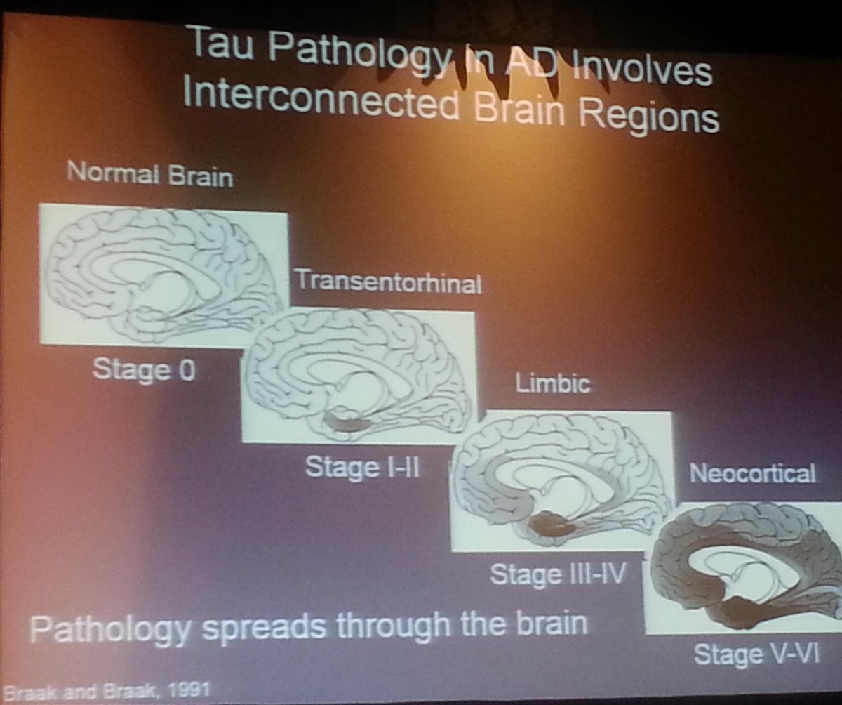 griz1's tweet photo. #Tau assoc w multiple #dementias, correl w cognitive deficits &amp; may spread thruout #brain @ACRMtweets #PIRR2015 https://t.co/48bBLrWsmQ
