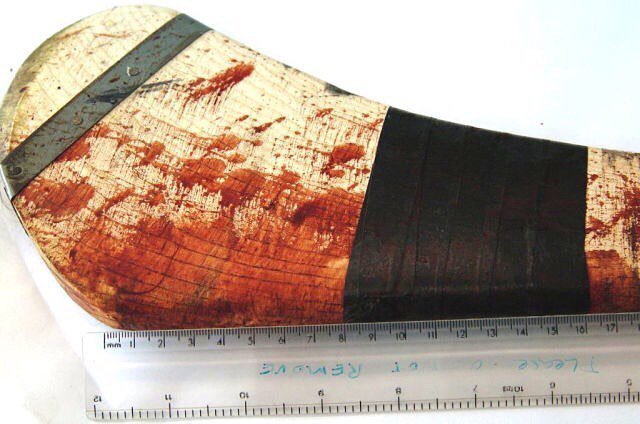 CienciasCFJP's tweet image. What do you notice in this picture?

#characteristics #bloodpattern #hurley #hurling #assault #daretoask #csi #fore…