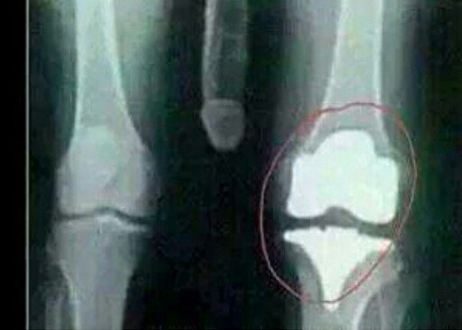 masaku_'s tweet photo. The game be like "I dislocated my knee fam" https://t.co/tfTTjRUvb3
