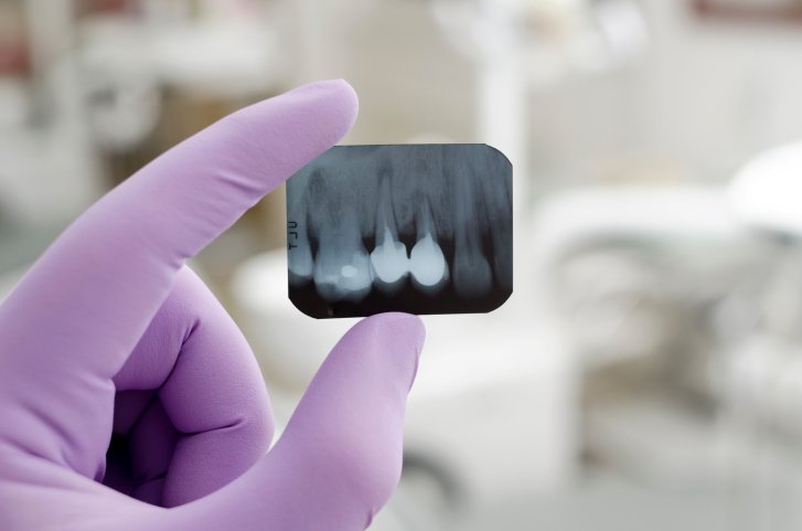 wellwithinyou's tweet photo. How Dental Implants Can Improve Oral Health https://t.co/0hncaxqpD9 https://t.co/XAvgYkjbKF