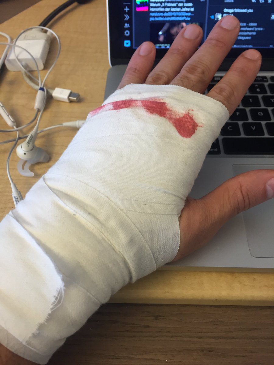 jasondhi's tweet photo. Oops. Wrapping my hands makes it really hard to type. #notthinkingahead https://t.co/nkwKhogWCS