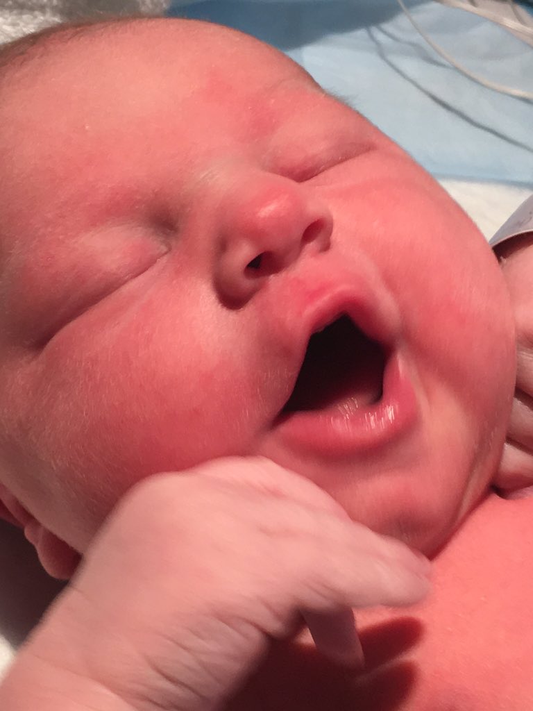 drstelnicki's tweet photo. Baby Ava has arrived #newbabystelnicki #newsister #yetanotherweddingtopayfor https://t.co/2omqZ4grXZ