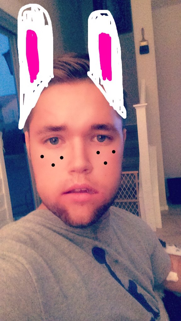 TheBrodyy's tweet photo. So I got my wisdom teeth out this morning which meant I had to turn myself into a bunny on snapchat #SwollenCheeks https://t.co/xYq5VnkSrV