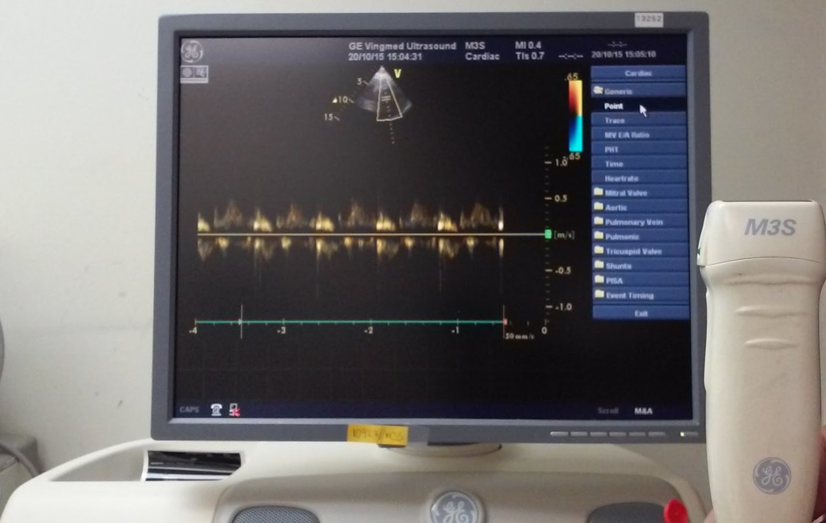equipamosllc's tweet photo. We Sell a #GE #Vivid7 #SharedServices #Ultrasound
More info?, Contact US!!!
**THIS EQUIPMENT IS A USED EQUIPMENT** https://t.co/S1KrclhM31