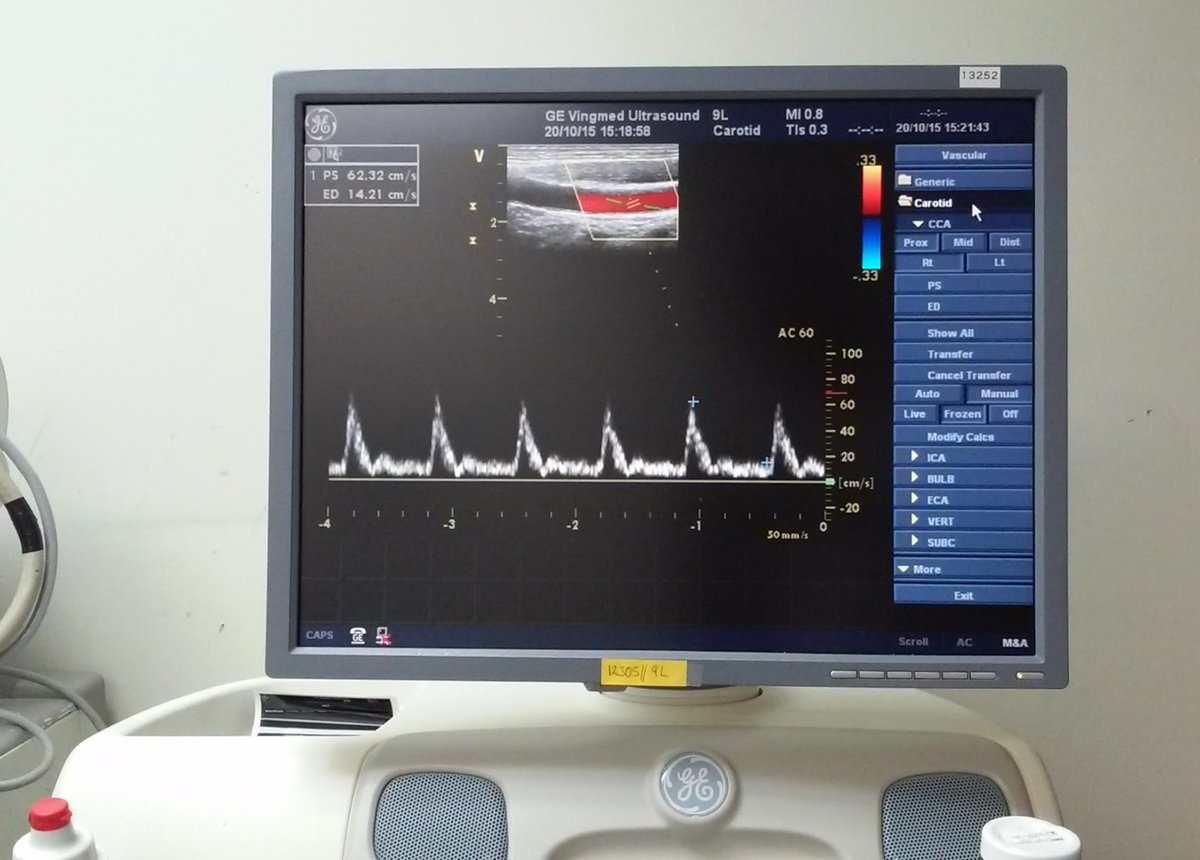 equipamosllc's tweet photo. We Sell a #GE #Vivid7 #SharedServices #Ultrasound
More info?, Contact US!!!
**THIS EQUIPMENT IS A USED EQUIPMENT** https://t.co/S1KrclhM31