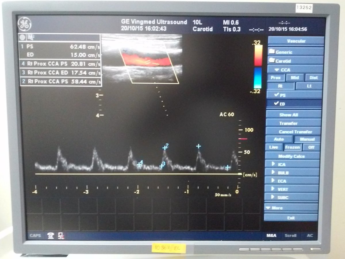 equipamosllc's tweet photo. We Sell a #GE #Vivid7 #SharedServices #Ultrasound
More info?, Contact US!!!
**THIS EQUIPMENT IS A USED EQUIPMENT** https://t.co/S1KrclhM31