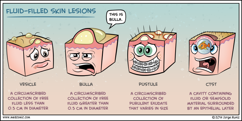 MedComic's tweet photo. Fluid-filled Skin Lesions
#MedEd #FOAMed https://t.co/AexY9w4Vth https://t.co/ZKqwC4ytOQ