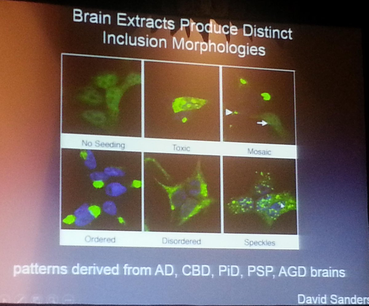 griz1's tweet photo. Different patterns of aggregation...diffnt diseases? #DrMarcDiamond #PIRR2015 @AANMember @ACRMtweets @TheNewANA1 https://t.co/XA4c5dPavg
