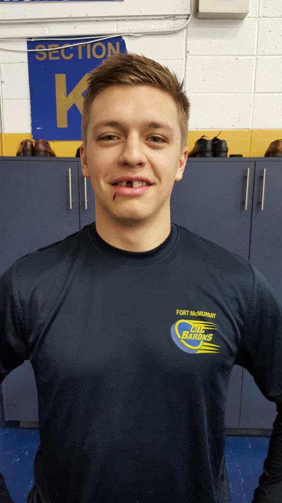 BradleyKarp's tweet photo. Does @Mtorrens5 play hockey for @MOBHockey? Can't tell. Too many teeth. 

#ymm #AJHL #OilBarons https://t.co/gLLXT48Dgi