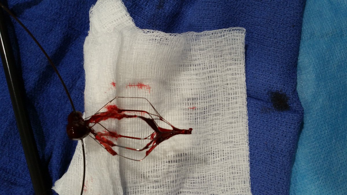 kmadass's tweet photo. Another day, another filter out @arslanmd @jtass6 #irad #LasersAreCool. Keep them coming. https://t.co/jUlkVQtoQw