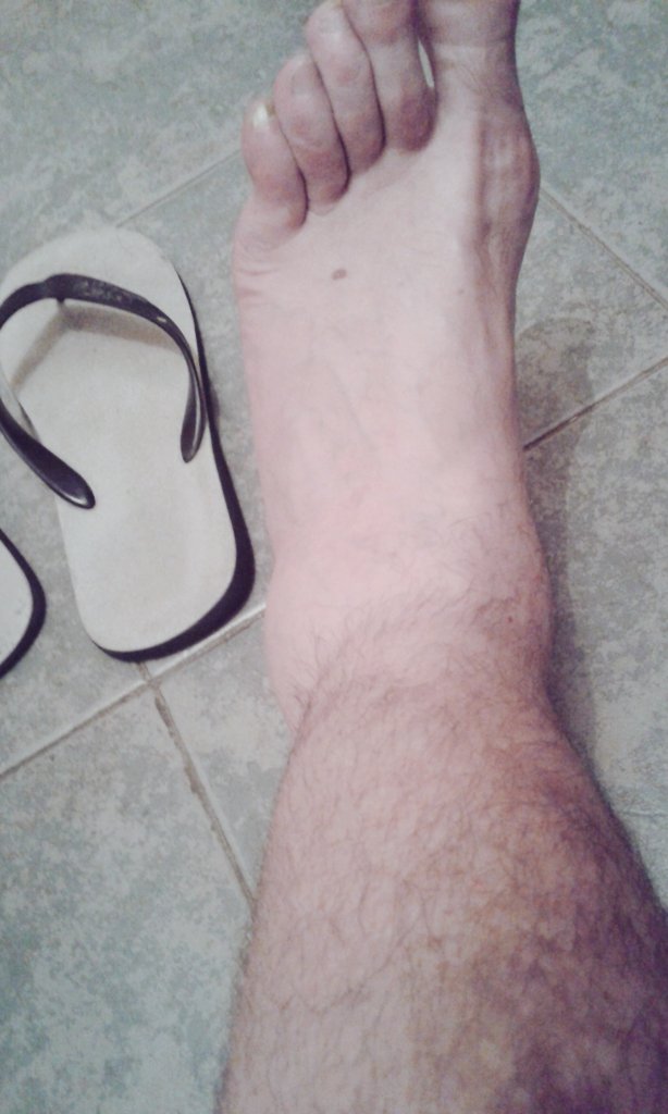 NicoTriboli's tweet photo. No me dejes sin ayuda
Oh San Batigol!
Que no hubo fútbol por lluvia
Pero debo hacer pick&roll #LeftAnkle #pantobillo https://t.co/2t0m1TTQ4Z