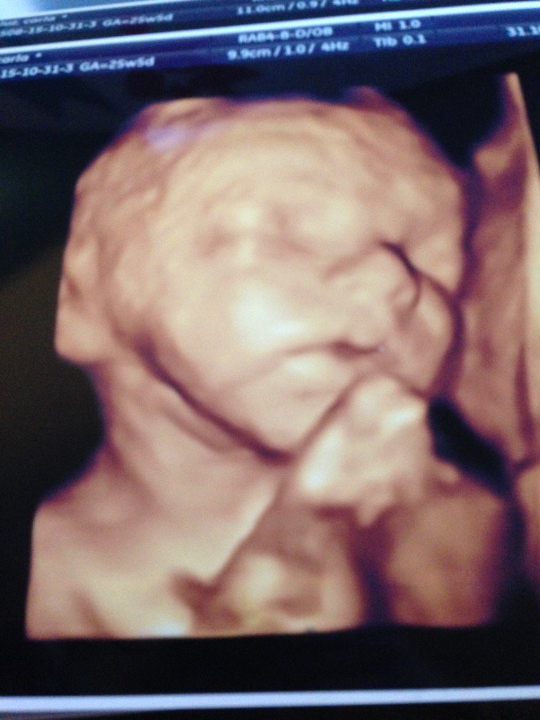 johnwhite1888's tweet photo. Can't wait till February to see this wee guy 👶🏻🍼💙 https://t.co/C6gMBtUUrE