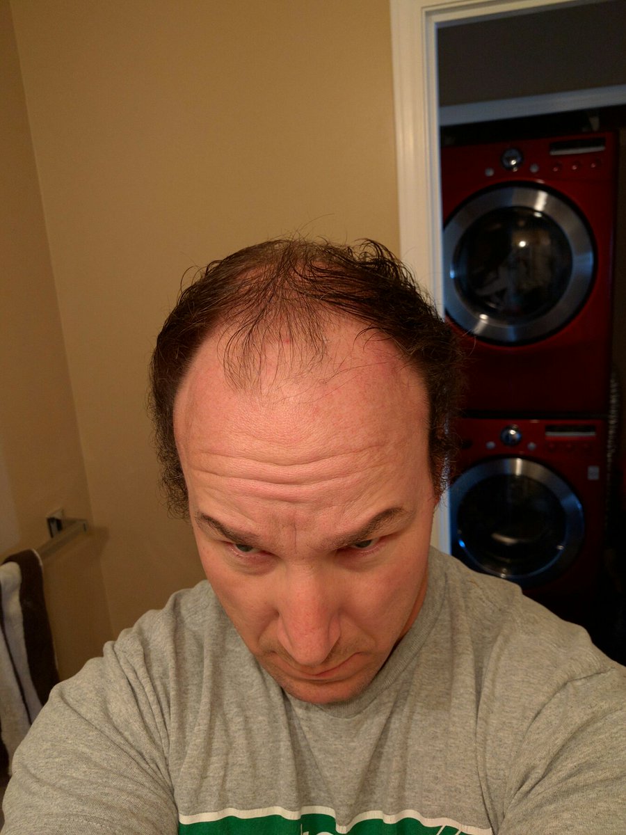 Boc40's tweet photo. Double comb-over #perfected https://t.co/000H3XMaHF
