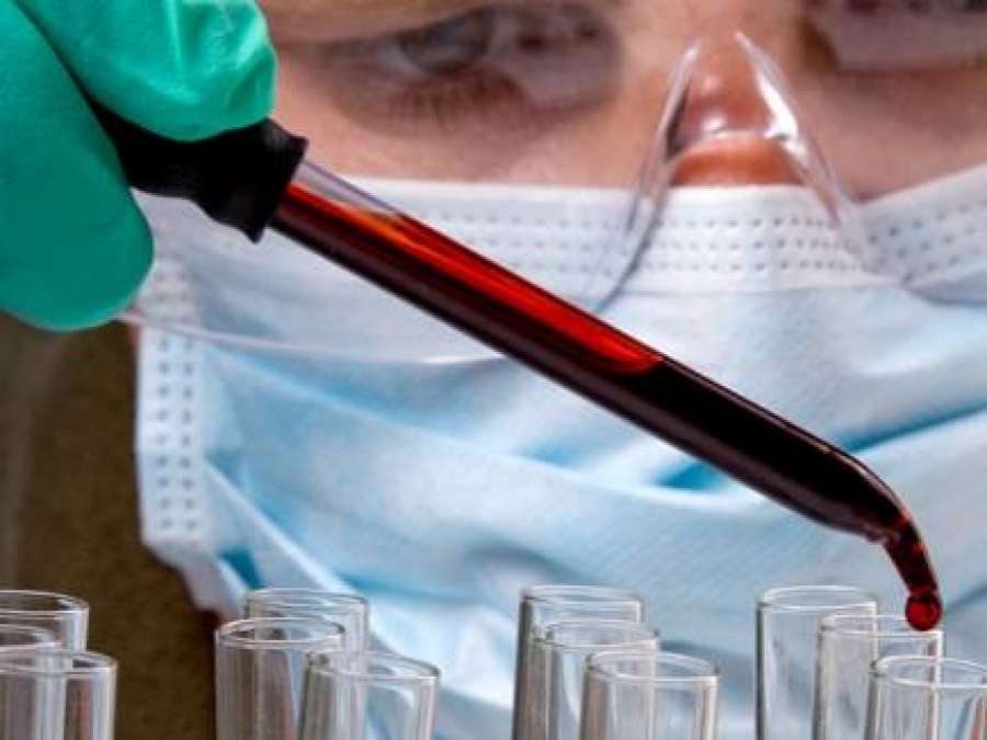A3Noticias's tweet photo. Desarrollan una técnica para detectar el cáncer con una sola gota de sangre https://t.co/2eg05yfLYN https://t.co/zdGfDI9pOV