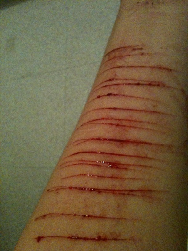 WereErupt tweet picture