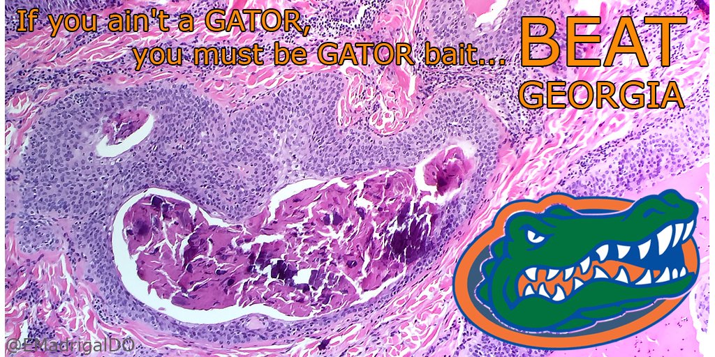 EMadrigalDO's tweet photo. Gator chomping on some #acrospiroma #beatGeorgia #UGAvsUF #pathologyart #dermpath https://t.co/WOX1CcNg2I