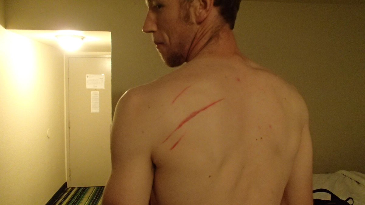 Snakey_Jakey22's tweet photo. Apparently I played against a velociraptor tonight...#clawmarks https://t.co/6MXnSEMWlu