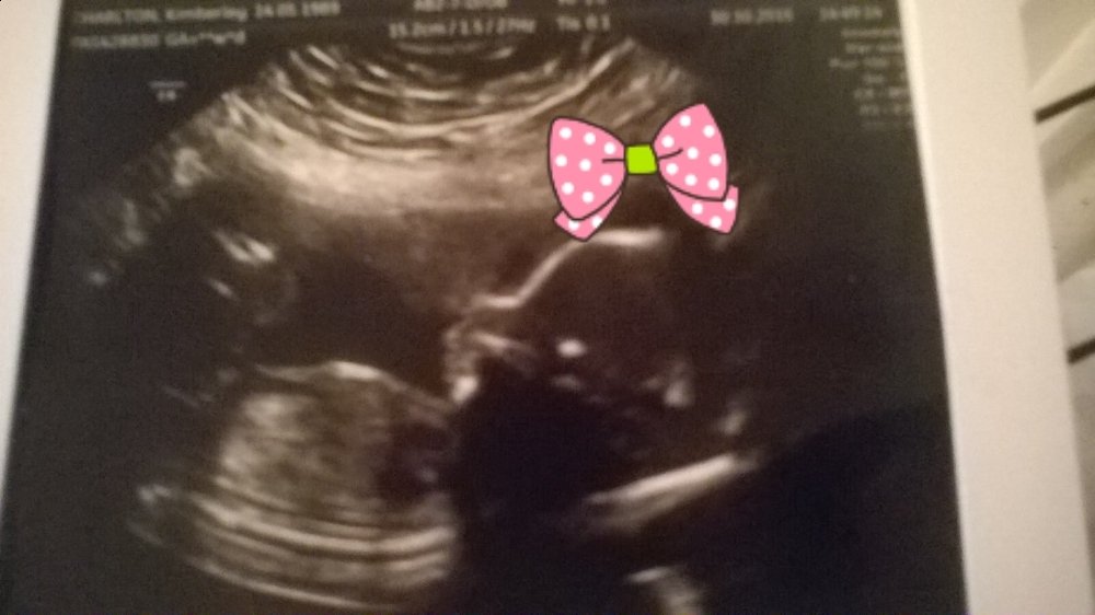 Kymbobley's tweet photo. Its a girl xx https://t.co/l3zHu0D46A