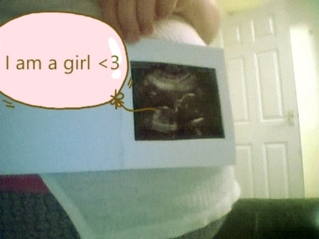 Kymbobley's tweet photo. Its a girl xx https://t.co/l3zHu0D46A