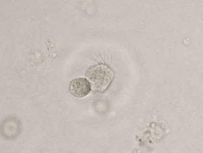 Answer to Parasite Case 369: parasitewonders.blogspot.com/2015/10/answer… #Pathologists <a href="/Pathologists/">CAPathologists</a> <a href="/JMGardnerMD/">Jerad Gardner, MD</a> <a href="/mayocliniclabs/">Mayo Clinic Labs</a>