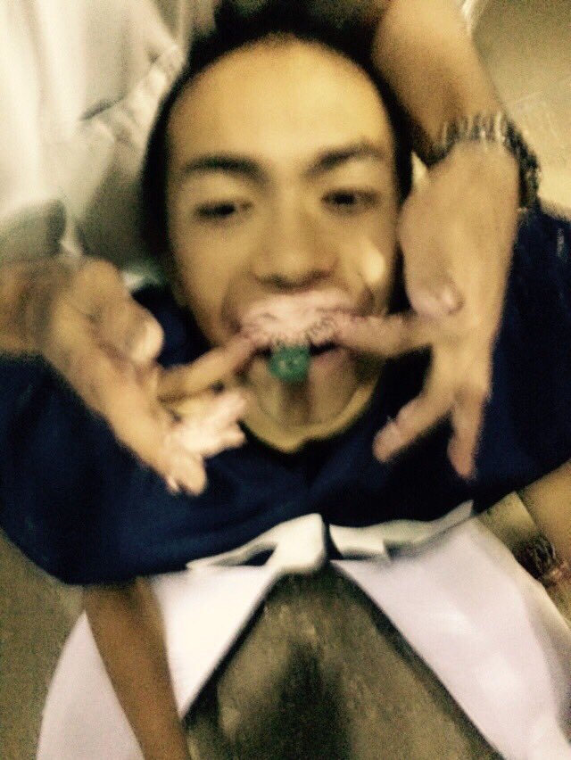 sameggggg's tweet photo. きのうはマウスピースを作りました https://t.co/OtpYKpj6sT