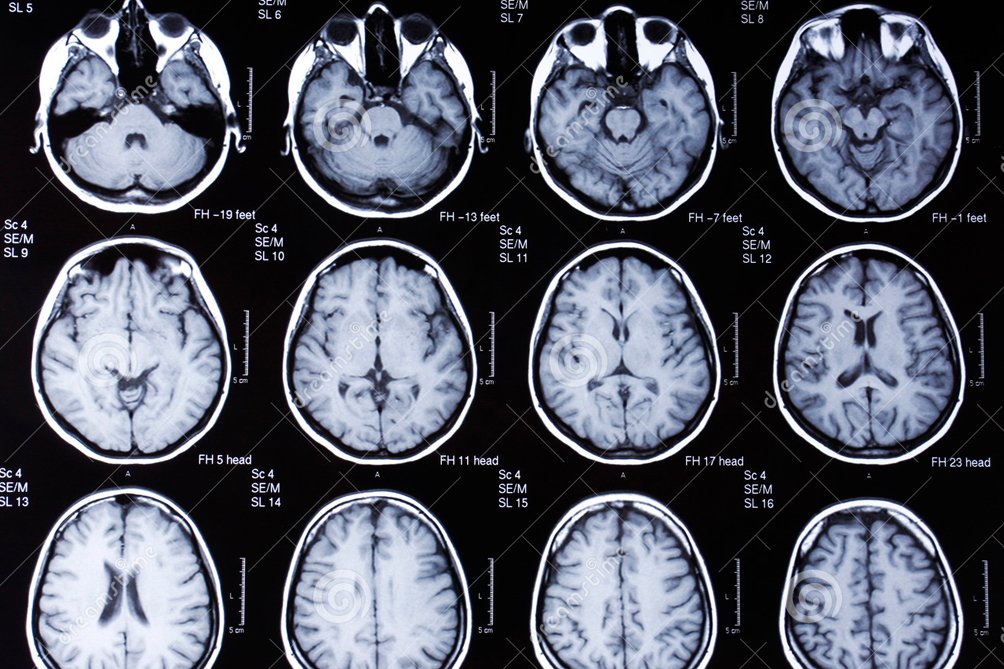 AgenciaTelam's tweet photo. Mostrarán esta semana en Plaza San Martín cómo funciona el cerebro https://t.co/VLCgImaq39 https://t.co/E5M1W7tv4C