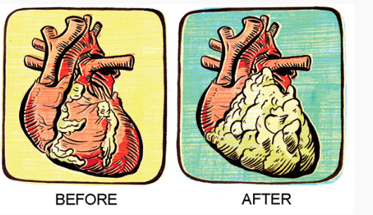 WomensHealthMag's tweet photo. Do you work out? Are you a couch potato or smoker? Your heart reveals the truth: https://t.co/8Pmdzu0Pms https://t.co/B45G79jVys