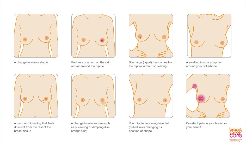 BreastCancerNow's tweet photo. #BreastCancerAwarenessMonth may be over but be sure to carry on checking yourselves for symptoms of breast cancer https://t.co/VnCHG97zWE