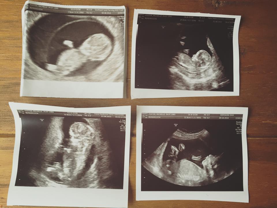 mizzaboo85's tweet photo. sending my own pictures off to be framed today!!!
#babyscan #frameset https://t.co/PYXnQSTAGA
