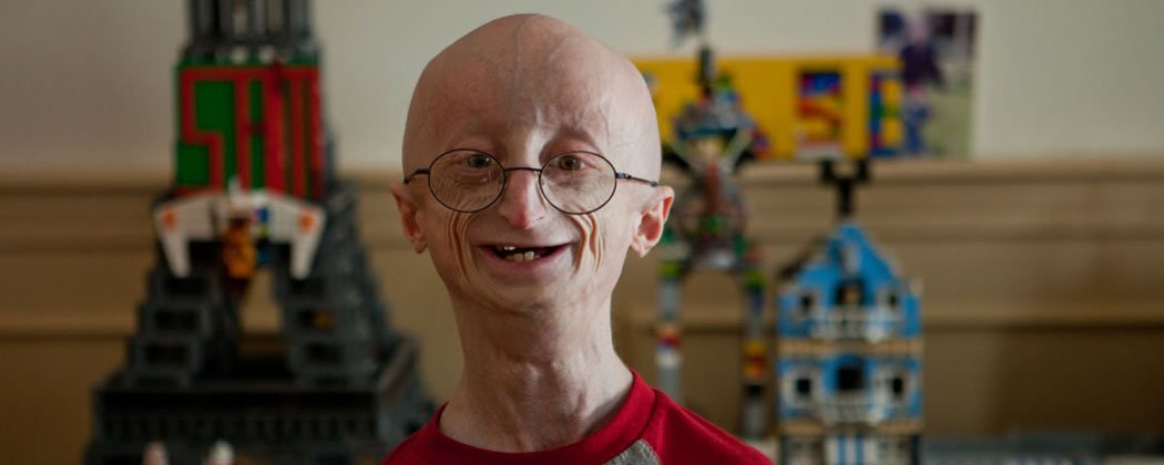 Nuevo vídeo: Las enfermedades y cuerpos mas raros que jamas has visto... te lo vas a perder? youtube.com/watch?v=QNPcr-…