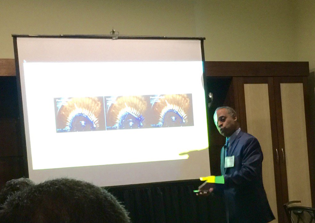 debh1028's tweet photo. Syd Tyson, MD, shares Dropless technique with recent adopters. #GoDropless #PCatAAO #AAO2015 https://t.co/6EvQPxy6e5