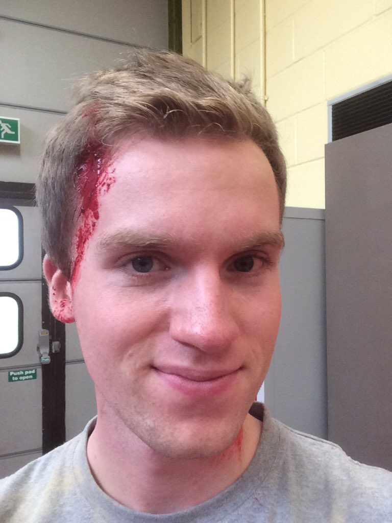 MichaelPenny19's tweet photo. Some lovely injuries courtesy of Paul Savage #epicc15 https://t.co/ODiafCdu9h