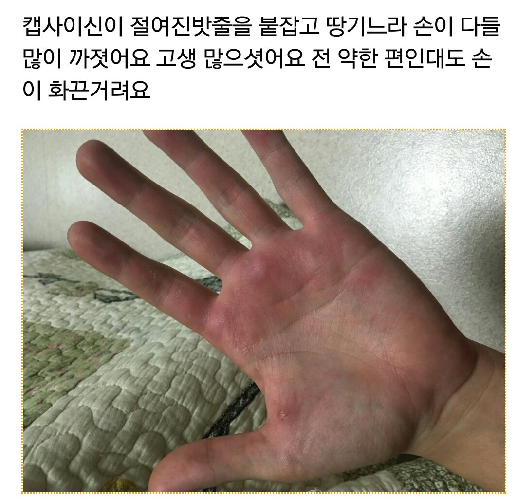 TrendsGem's tweet photo. 제 손 입니다.jpg https://t.co/eENJavsfhB 출처.오유 https://t.co/kdcQseSvsW