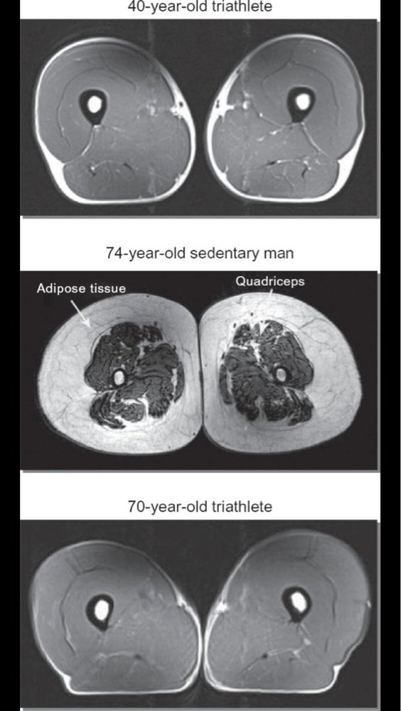 Physioimpulse's tweet photo. Having trouble convincing people of the benefits of exercise? Show them this pic! @Physiowizz @PhysioLocker https://t.co/kXsui6qKDf