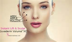 Try Voluma XC to lift and enhance cheekbones. Call #DrMizin at 818-225-2211