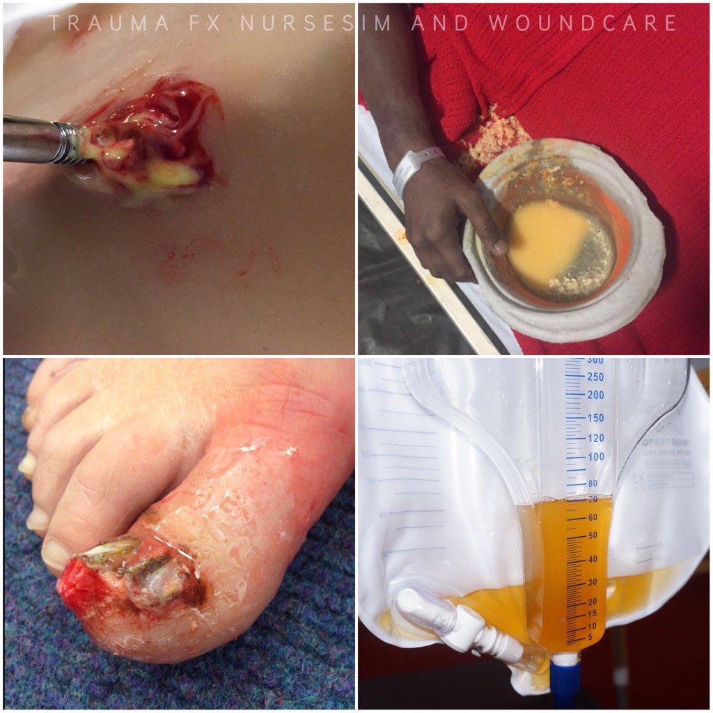 SIMBODIES's tweet photo. Trauma FX launches NEW NURSESIM and Wound Care simulation product range, https://t.co/v6izXV5TnH #SIMPUS #SIMVOMIT https://t.co/aMcDV2Mw2q