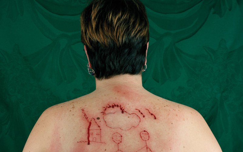 DryMagazine's tweet image. Read about queer artist Catherine Opie's photograph Self-Portrait/Cutting.
► dry-magazine.com/blood-drips-do…