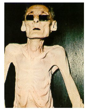 MCeriminal's tweet photo. Without our lipids you would look like this. https://t.co/xi1j4WC6no