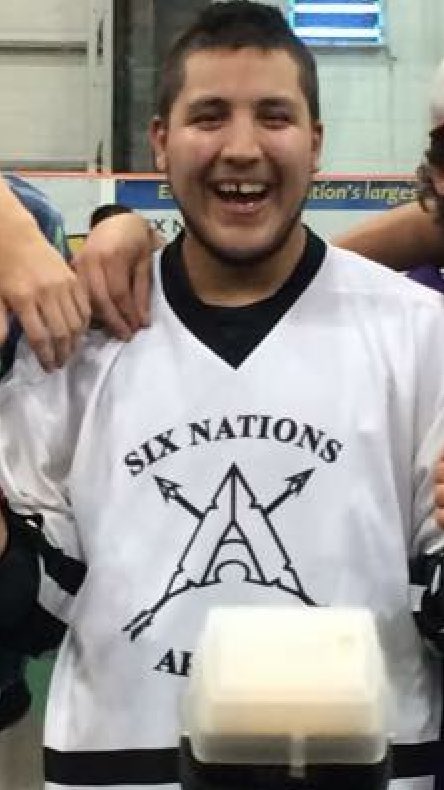 Who rocks the missing tooth better rt for <a href="/LetourneauLax/">Keegan Letourneau</a> fav for @jordanDurston8