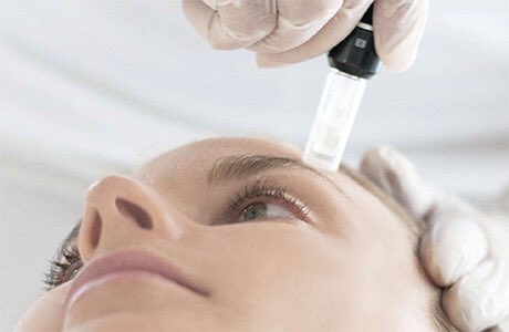 retronouveau1's tweet photo. First Microneedling Session only $150 through 12/31/15! Schedule today! https://t.co/bNQpBZWds5