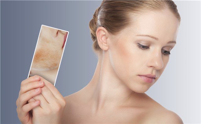¿Piel sensible? Aquí tienes 10 tratamientos para cuidarla.
mujerhoy.com/belleza/blog-t…