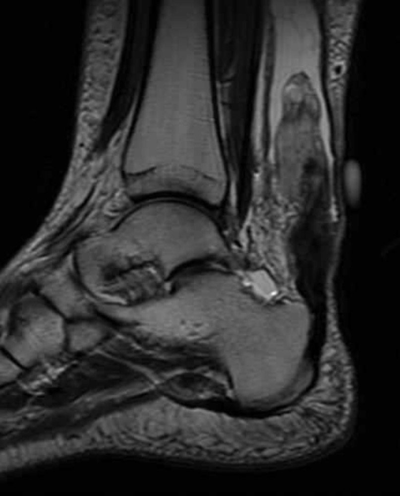JamesBig1994's tweet photo. Scan looks scary, surgery over weekend 
Kind of wish I was in San Francisco for this one https://t.co/bFtwCmB6QX