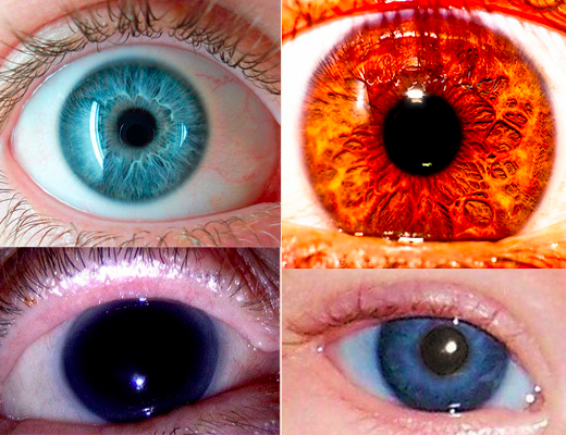 domalexander345's tweet photo. "Most human eyes are brown or blue, but other colors like hazel and gray are more rare"
#PWAGBIO https://t.co/i9zLOeTlRl