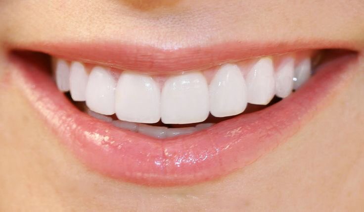FeelGoodTweetz's tweet photo. If I had teeth like this, I would never not be smiling.... https://t.co/QV3cFjlqlq