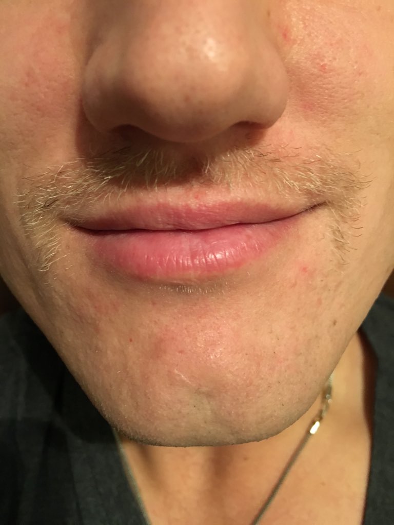 Ludsy17's tweet photo. Mavembers here, I'm looking for Mo Bros &amp; Sistas to help. https://t.co/xUkXuDywBS #Movember @Movember @MissouriMavs https://t.co/LZ7TBtFC5x